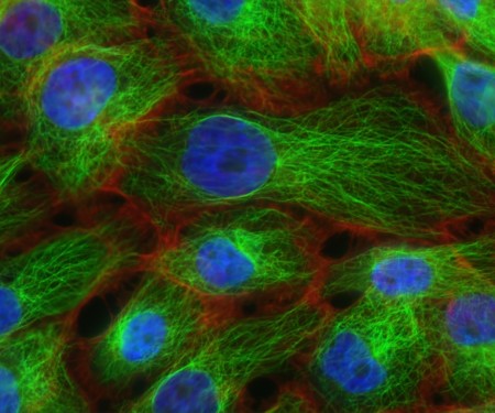 impacte percepció a les cèl.lules - Sínia Institut