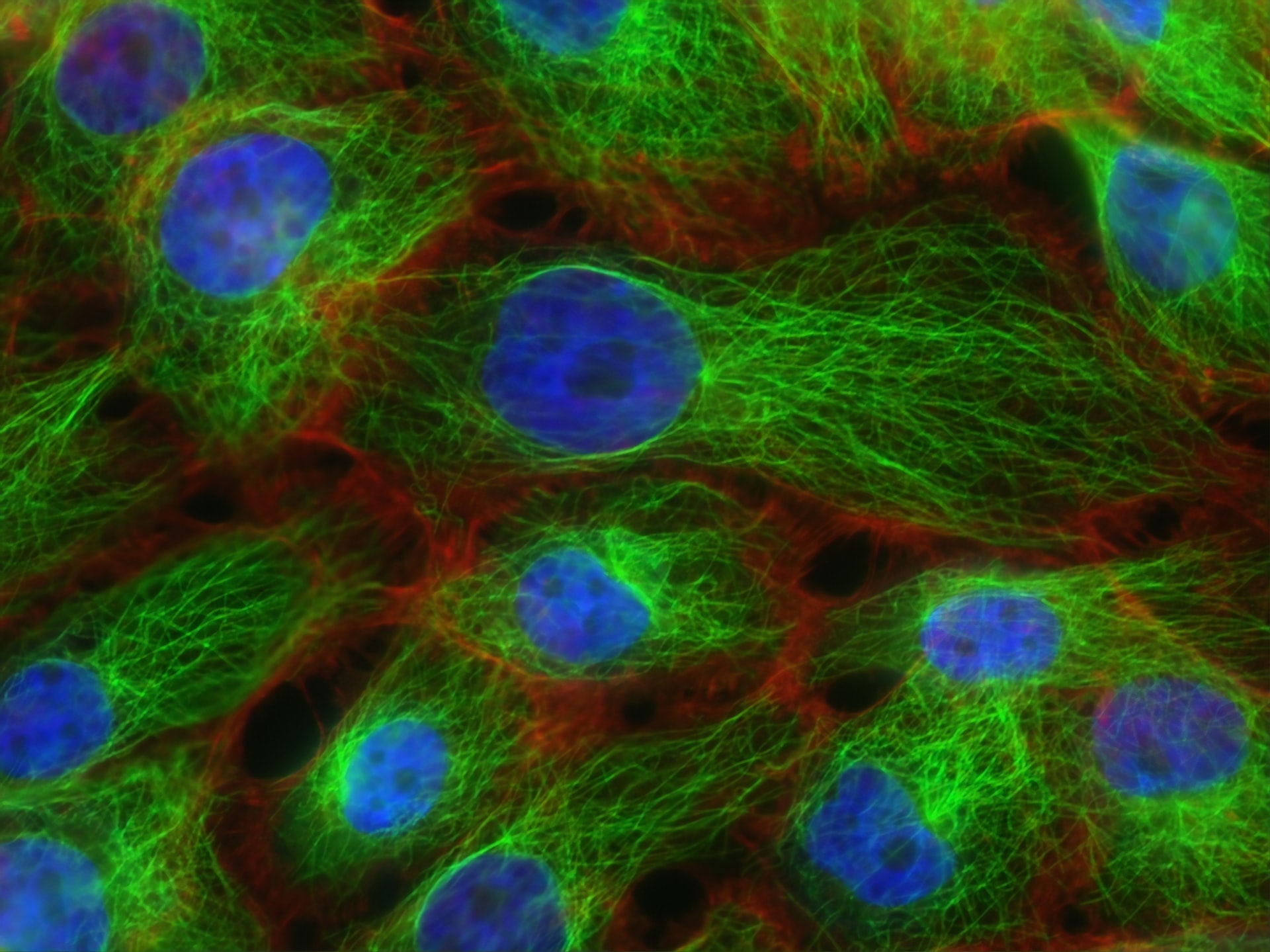 impacte percepció a les cèl.lules - Sínia Institut